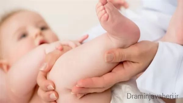 درمان دررفتگی لگن در نوزادان