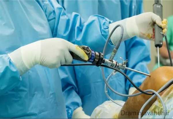 درمان پارگی رباط صلیبی در فوتبال با جراحی آرتروسکوپی