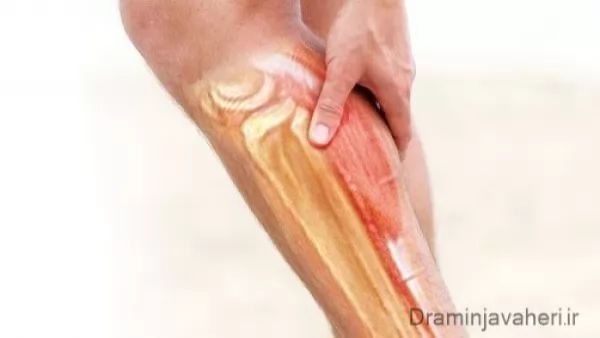 درد ساق پا به دنبال گرفتگی عضلات