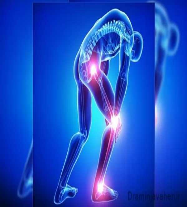 دردها و بیماری های مفصلی در زانو و لگن
