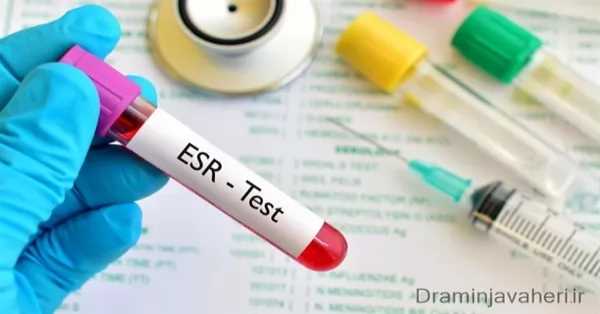 تشخیص آرتروز با آزمایش ESR
