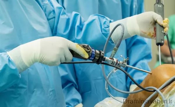 درمان آب آوردن زانو با جراحی آرتروسکوپی